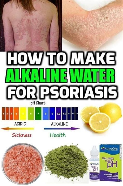 Learn about these 14 natural treatments national psoriasis foundation: Home Remedies for Psoriasis | Home remedies for psoriasis