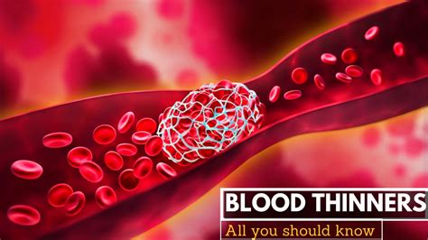 Blood Thinners Everything You Need To Know Youtube