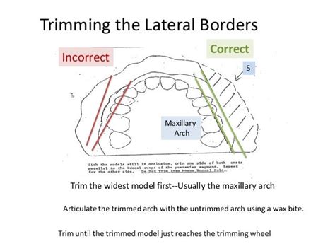 Study Models 101 Trimming