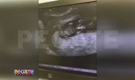 La Burbu comparte sonograma de su nuevo bebé Primera Hora