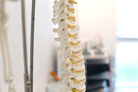 What Do Chiropractors Do How Can We Help You At Staines Chiropractic