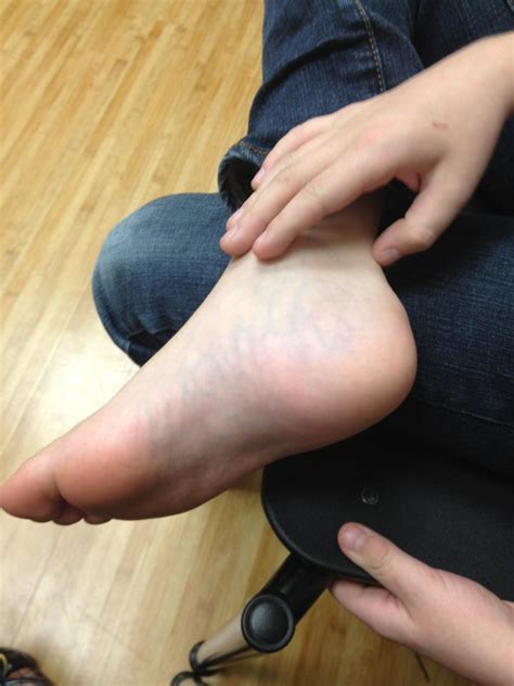 At first, the pain is not constant. Tristan, Bone Cancer's got nothing on "U": Things change