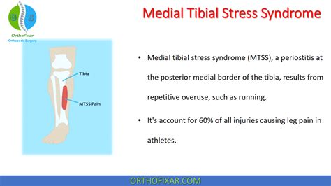 Orthopedic Sports Medicine 2022 Orthofixar