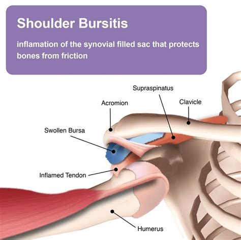 Shoulder Anatomy Bursa Images Human Anatomy Learning Bursitis