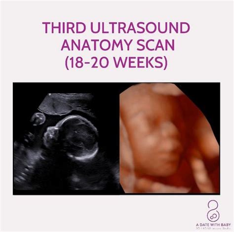 Gender 3d Ultrasound 18 Weeks What To Expect Boy Vs Girl