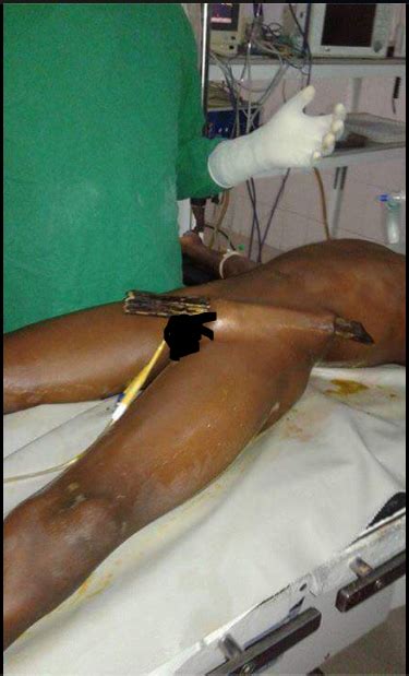 Huh Man Saved By Nigerian Doctors After Being Injured