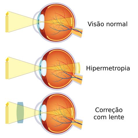 Quais São As Partes Do Olho E Suas Funções Sobre Os Olhos