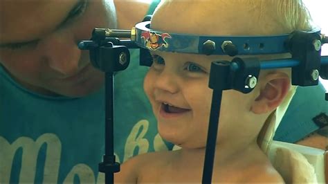 Jaxon Taylor Injury Toddlers Head Reattached After Internal