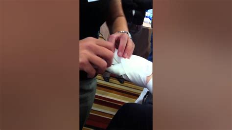 Hand Bandaging With Mobiderm Demo For Lymphoedema Youtube