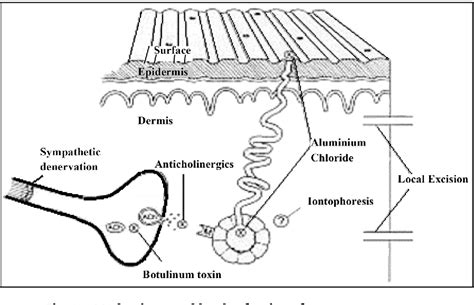 Figure 1 From Axillary Hyperhidrosis A Review Of The Extent Of The