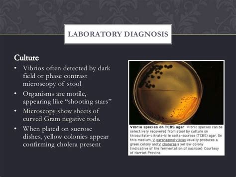 Study Solution And Tutorial Laboratory Diagnosis Of Cholera