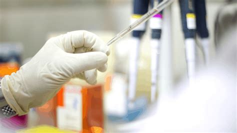 Treatment side effects can include: Types of HIV Tests - HealthiNation