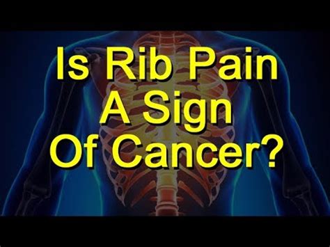 During and just after treatment, your treated breast may be sore. Is Rib Pain A Sign Of Cancer? - YouTube