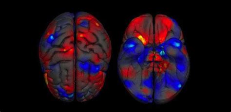 Males And Females Differ In Specific Brain Structures University Of