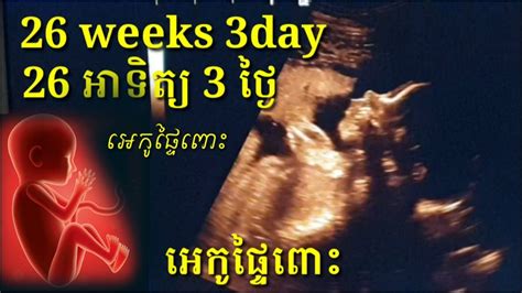 អេកូផ្ទៃពោះ 26អាទិត្យ 3ថ្ងៃ Pregnancy Ultrasound 26week 3day By Drbun