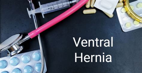Causes Symptoms And Treatment Of Ventral Hernias Facty Health