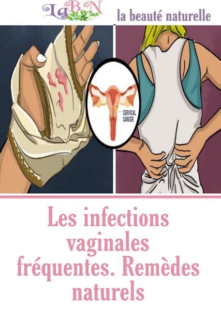 Les Infections Vaginales Fr Quentes Rem Des Naturels Beauty Hacks