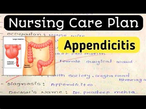 Nursing Care Plan On Appendicitis Nursing Diagnosis Nursing Process
