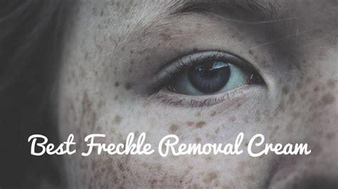 The Best Freckle Removal Cream Reviews And Buying Guide In 2022