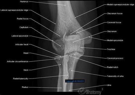 Elbow﻿ Radiography Anterior Posterior View Lateral Epicondyle