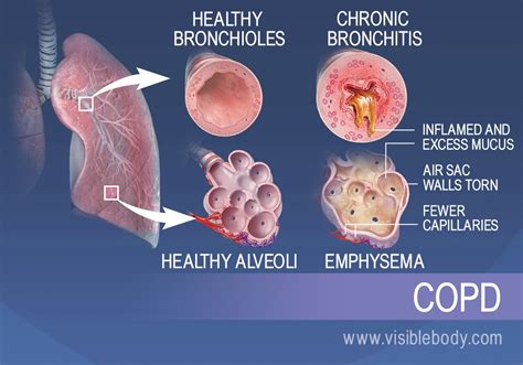 Respiratory Diseases And Disorders Respiratory Anatomy