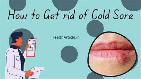 How To Get Rid Of Cold Sores Fast 7 Magical Remedies