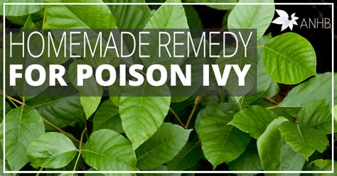 Homemade Remedy For Poison Ivy Updated For 2018