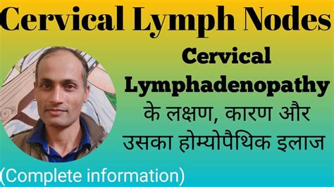 Cervical Lymphadenopathy Homeopathic Medicine For Cervical Enlarged