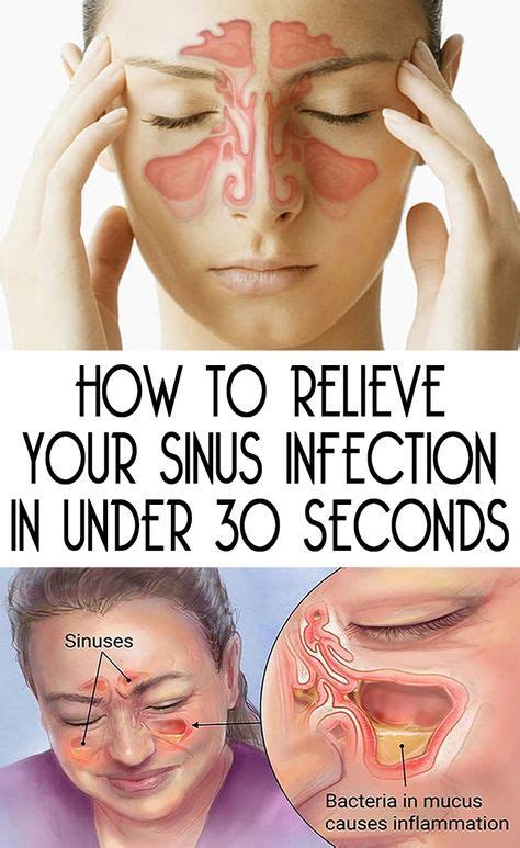 Quick Way To Relieve Sinus Pressure Just For Guide