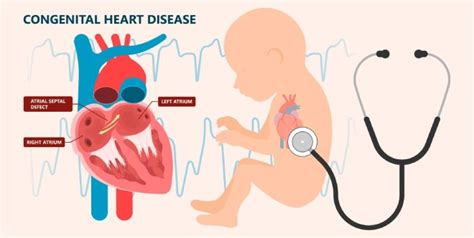 Congenital Heart Disease Treatment In Pune Congenital Heart Disease