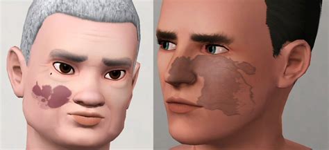 Mod The Sims Birthmark Six Pack Collection