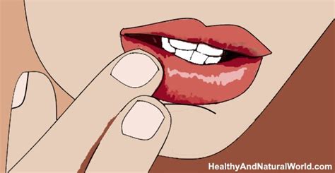 Did you know there are different types of acne pimples? Pimple on Lip: Causes and Effective Natural Treatments