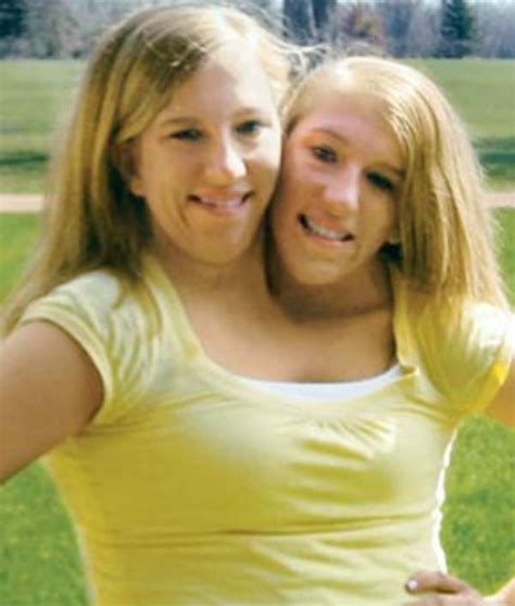 What The Famous Conjoined Twins Abby And Brittany Hensel Are Up To