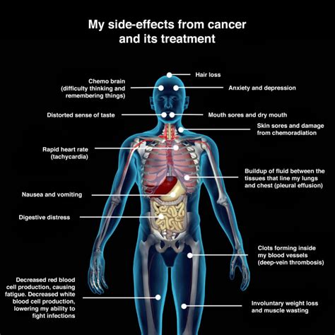 The most commonly reported side effects, which typically lasted several days, were pain at the injection site, tiredness, headache, muscle pain, chills of note, more people experienced these side effects after the second dose than after the first dose, so it is important for vaccination providers and. Hpv vaccine side effects bleeding. Atentie la vaccin ...