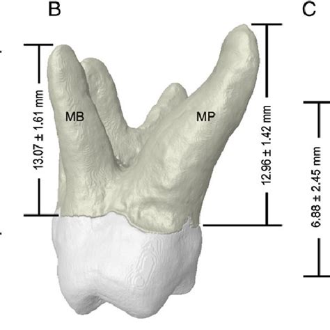 3d Reconstructions Of 4 Rooted Maxillary Second Molars Showing