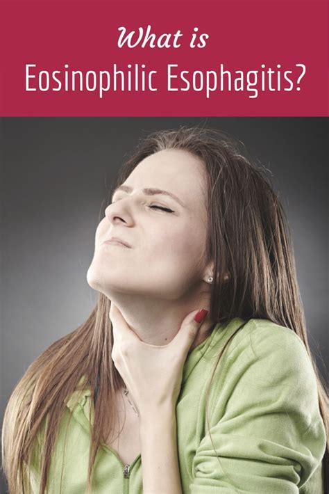 What Is Eosinophilic Esophagitis Esophagitis Esophagitis Diet