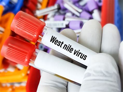 West Nile Virus Causes Symptoms Diagnosis Treatment