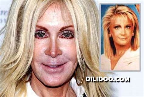 When Plastic Surgery Fails 38 Pics Izismile Com