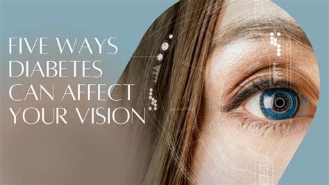 Five Ways Diabetes Can Affect Your Vision Krishna Eye Centre