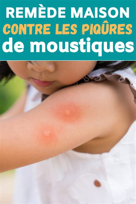 Les piqûres de moustiques sont désagréables et causent des