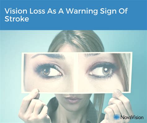 Vision Loss As A Warning Sign Of Stroke Novavision