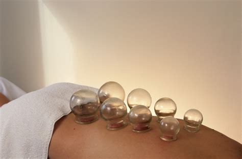 Cupping Health Benefits Blackdoctor