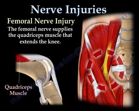 Nerve Injuriesinjury Everything You Need To Know Dr Nabil
