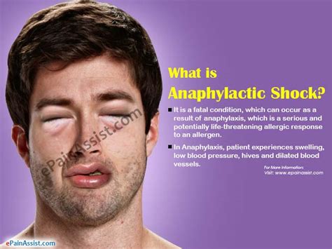 What Is Anaphylactic Shockcausessymptomstreatmentprognosisprevention