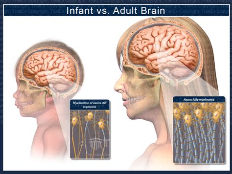 Infant Vs Adult Brain Trial Exhibits Inc
