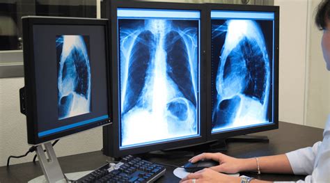 O Que Voc Precisa Saber Antes De Optar Pela Radiologia Digital