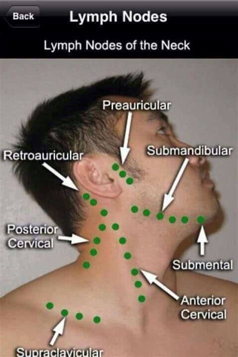 Lymph Nodes Of The Neck Medical Knowledge Medical Education Medical