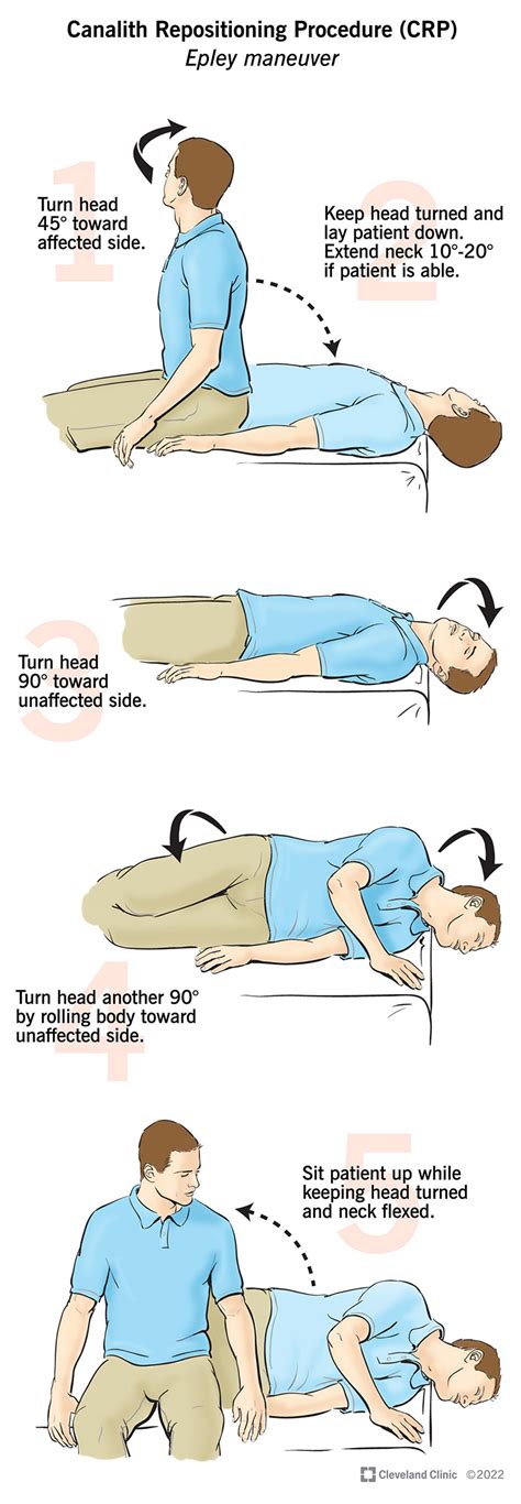 Epley Maneuver To Treat Bppv Dizziness Epley Maneuver Physical Images And Photos Finder