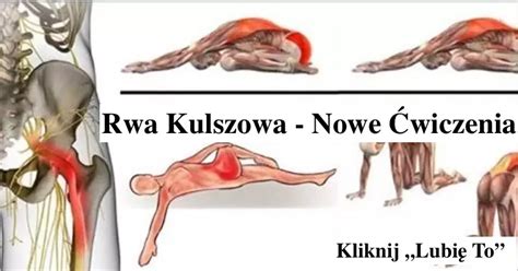 Rwa Kulszowa Nowe Wiczenia Na B L Koniecznie Zastosuj I Po B Lu