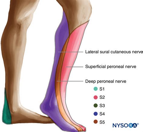 A sciatic nerve block is a nerve block that uses local anesthetic to achieve analgesia in the leg. Sciatic Nerve Block - Landmarks and Nerve Stimulator ...